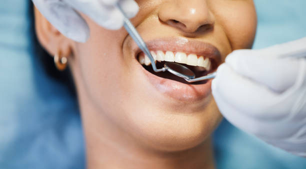 Best Dental Abscess Treatment in Salina, OK